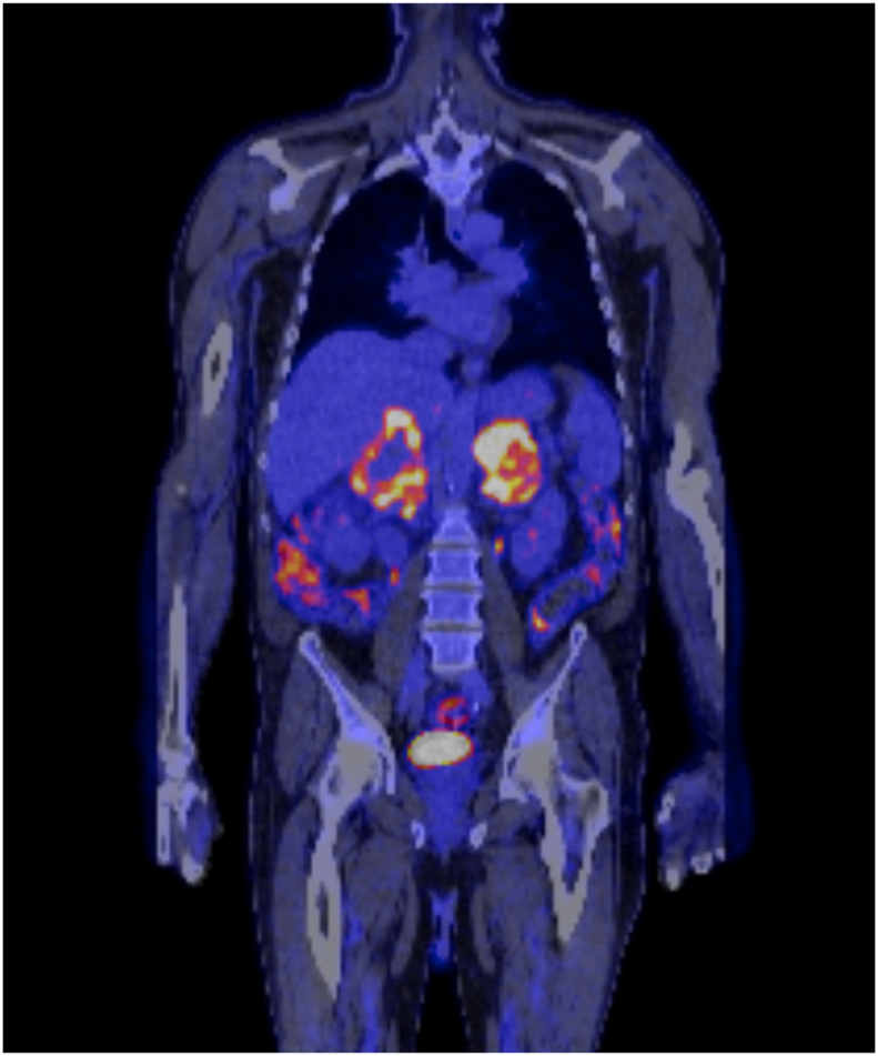 Fig. 2