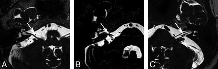 Fig 2.