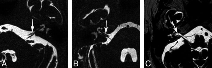 Fig 1.