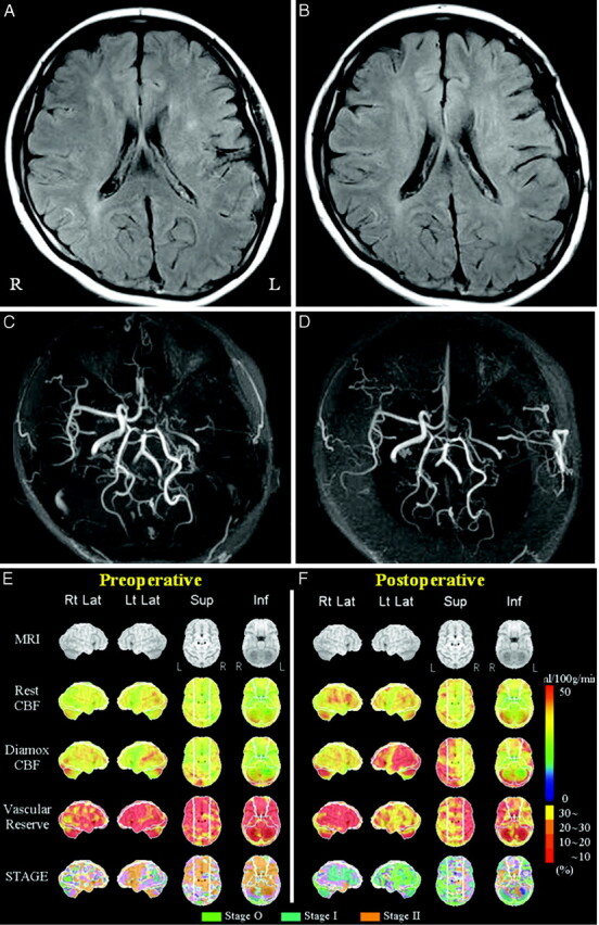 Fig 3.