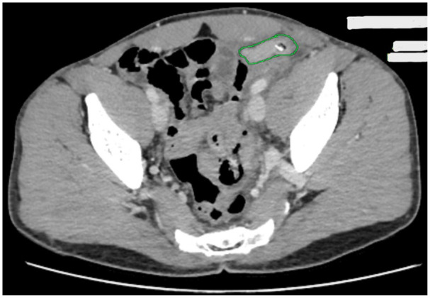 Figure 2.