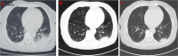 Fig. 1