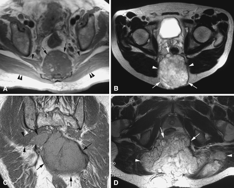 Fig. 2A–D