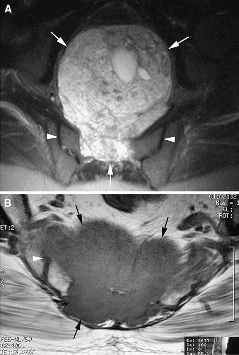 Fig. 1A–B