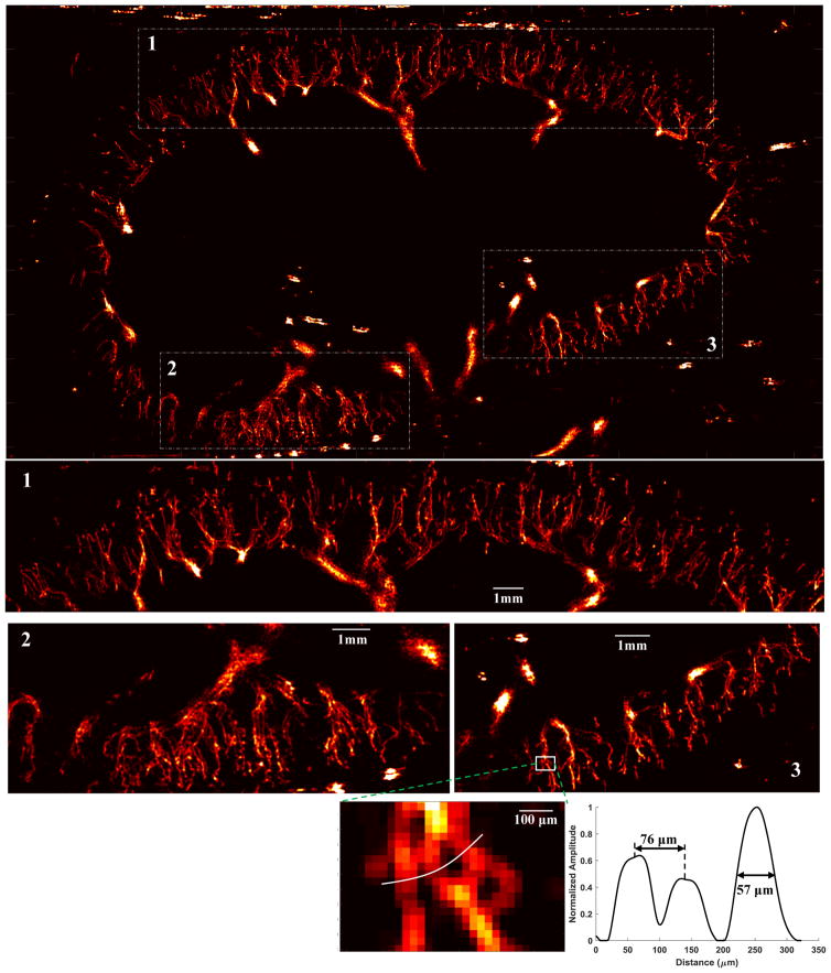 Figure 11