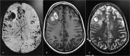 Fig. 12