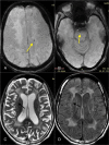 Fig. 13