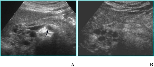 Fig 5