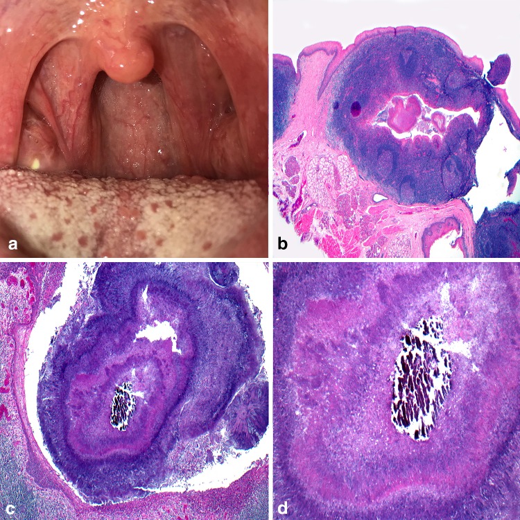 Fig. 6