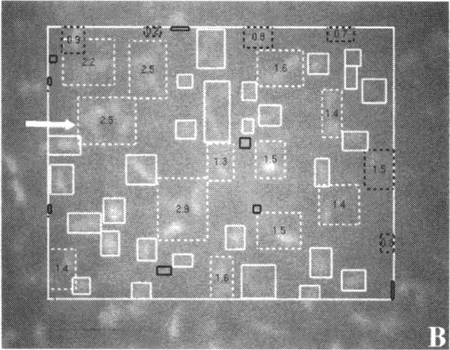 FIGURE 1 B