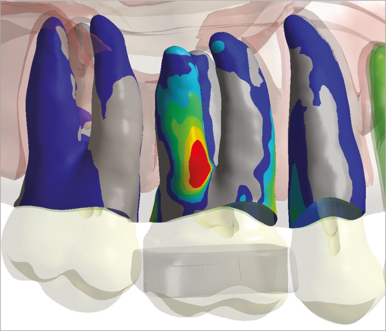 Figure 3 -