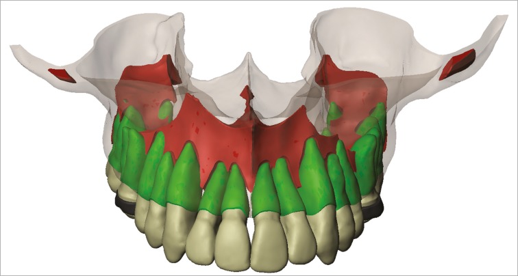 Figure 1 -