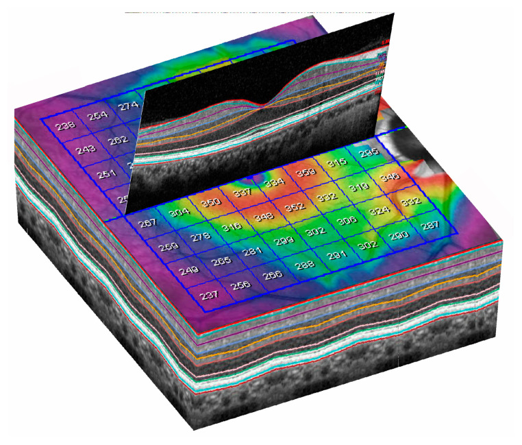 Figure 6