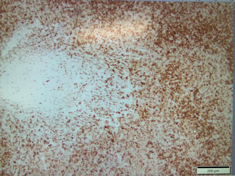 Figure 10