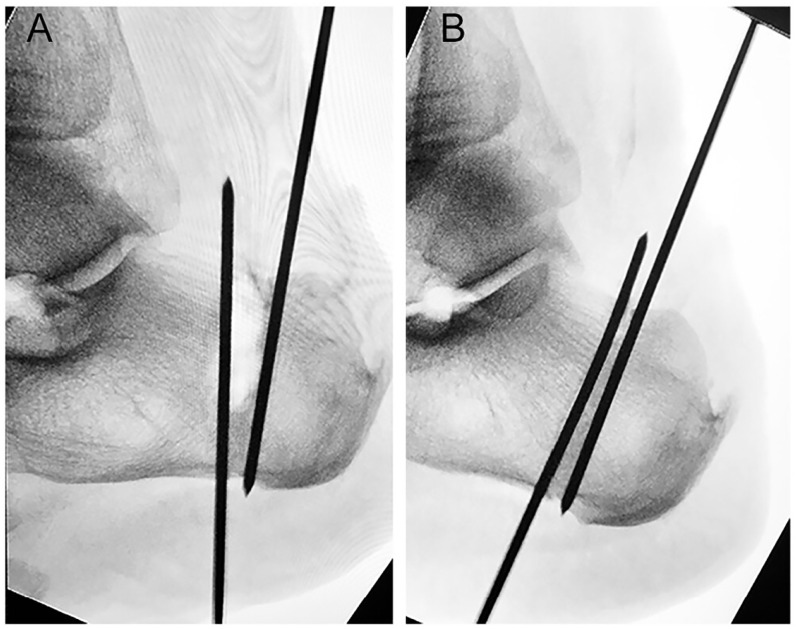 Figure 7.