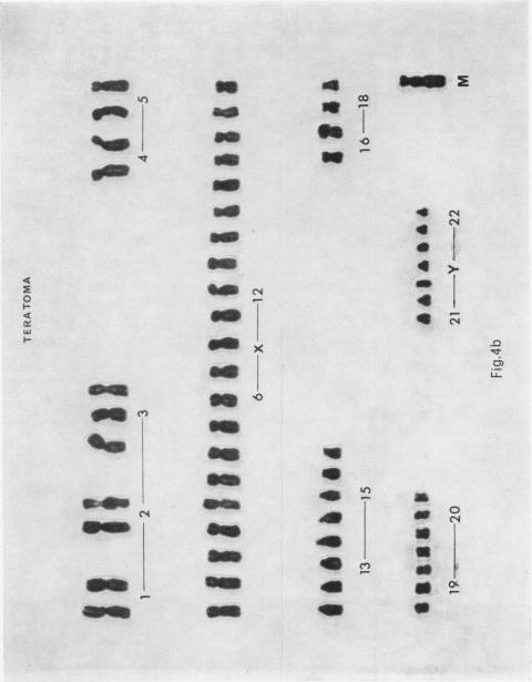 Fig. 4b