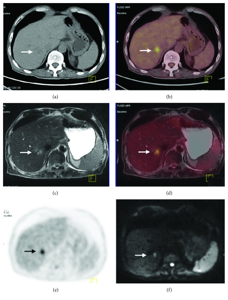 Figure 6