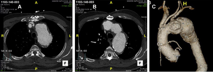 Figure 2