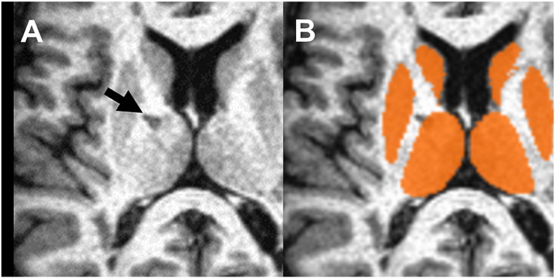 Fig. 4