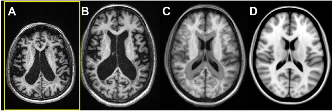 Fig. 2