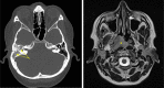 Figure 17.
