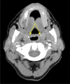 Figure 14.