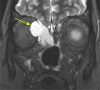 Figure 11.