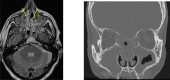 Figure 9.