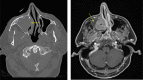 Figure 12.
