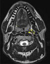 Figure 13.