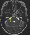 Figure 16.
