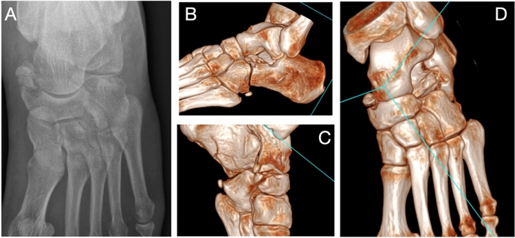 Fig. 2