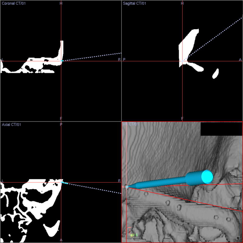 Figure 9