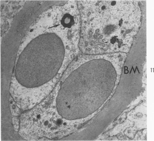 Fig. 11