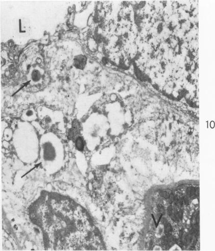 Fig. 10