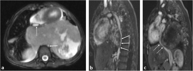 Fig. 21