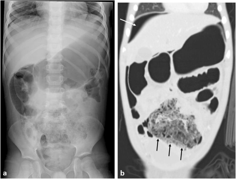 Fig. 14