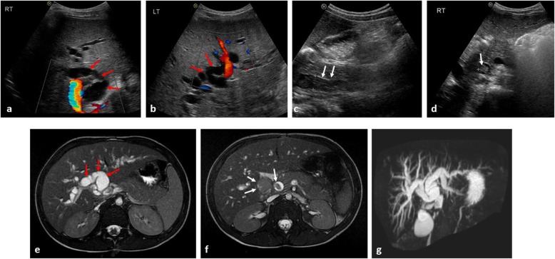 Fig. 16