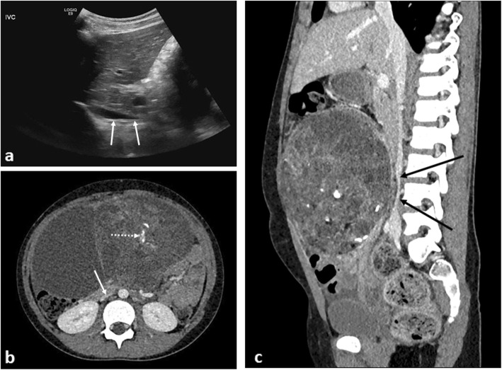 Fig. 12