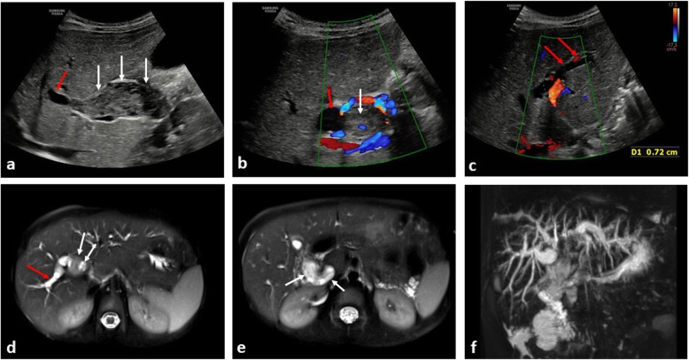 Fig. 15