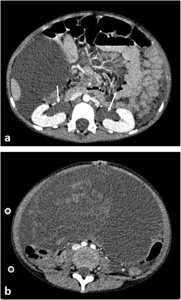 Fig. 17