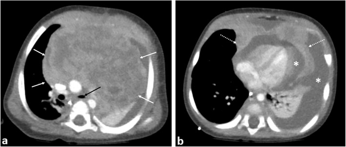 Fig. 10