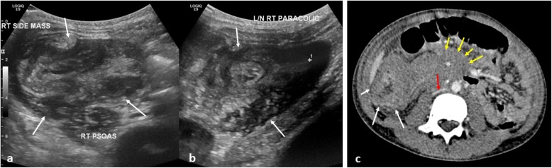 Fig. 13