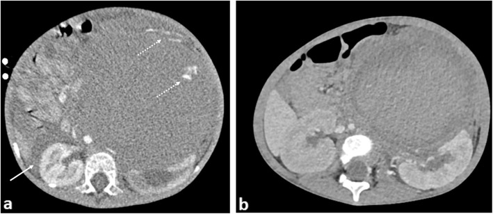 Fig. 20