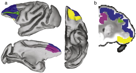 Fig. 2