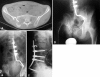Fig. 1A–D