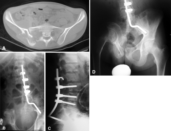 Fig. 1A–D