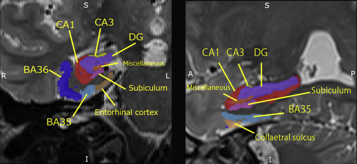 Fig. 1