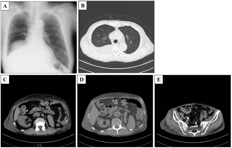 Fig. 1