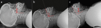 Fig. 4